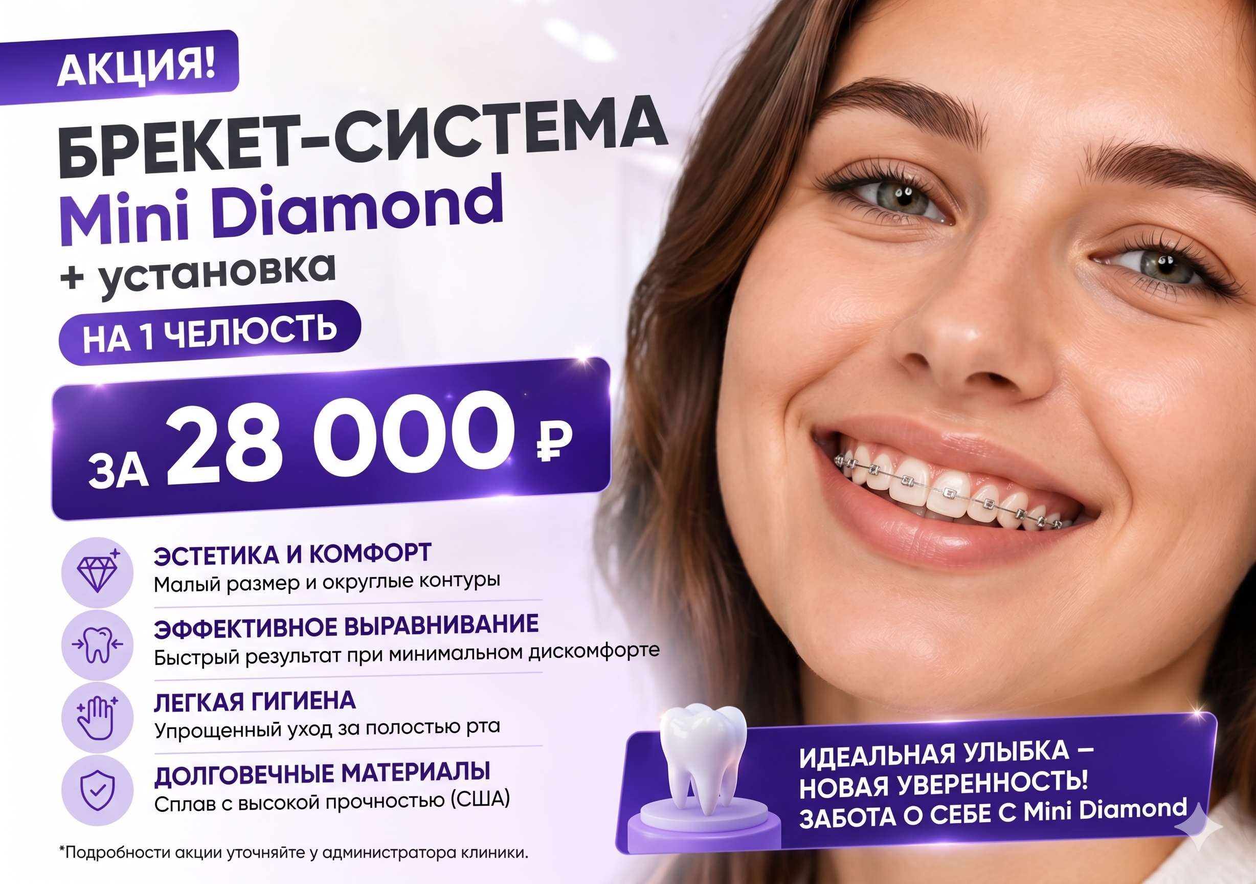 Брекеты MiniDiamond с установкой на одну челюсть за 28 000 рублей Брекеты MiniDiamond с установкой на одну челюсть за 28 000 рублей